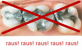 Amalgam ist
                        Sonderm�ll und muss sofort alles raus!