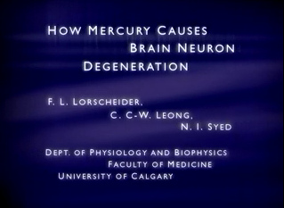 Film über
                              Quecksilberwirkung an Nerven 02: Titel
                              "How mercury causes brain neuron
                              degeneration", von F.L. Lorscheider,
                              C.C.-W. Leong und N.Y. Syed, von der
                              Abteilung Physiologie und Biophysiologie
                              der Medizinischen Fakultät der Universität
                              Calgary
