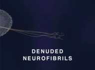 Film über
                                        Quecksilberwirkung an Nerven 09:
                                        Es bleiben nur noch nackte
                                        Nervenfasern (engl.:
                                        "denuded
                                        neurofibrils") übrig
