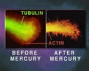 Nerv vor
                  und nach Quecksilberbefall: Quecksilber zerst�rt die
                  Nerven