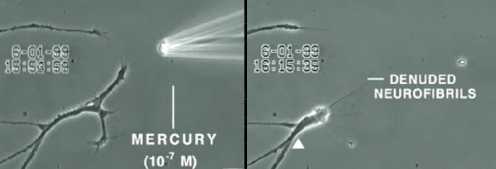 Nervenschaden (Nervenfaser) durch
                          Quecksilber. Das Amalgam-Qecksilber behindert
                          systematisch die Transportf�higkeit des
                          Tubuilns, und so bauen sich die Nerven
                          automatisch ab, und es bleibt nur noch die
                          tote Nervenfaser �brig. Der
                          SChul-"Medizin" ist das egal, und
                          die kriminellen, b�rsengeilen Regierungen
                          bezahlen weiterhin das Amalgam und die
                          Medikamenten gegen Nervenkrankheiten
                          gleichzeitig...