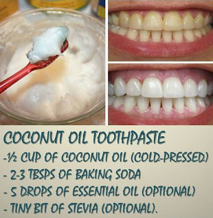 Recipe for a toothpaste coconut oil + soda +
              fragrance oil (optional) + birch sugar Stevia (optional)