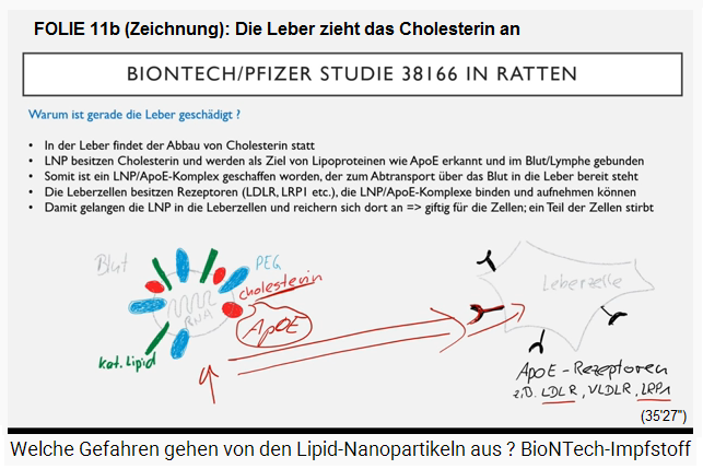 FOLIE 11b (Zeichnung): Die Leber
                zieht das Cholesterin an