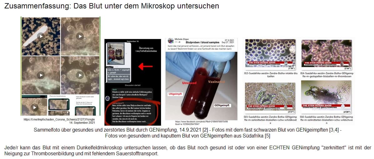 Blutuntersuchungen von gesundem und
                        zerst�rtem Blut durch
                        "Coronaimpfungen"
