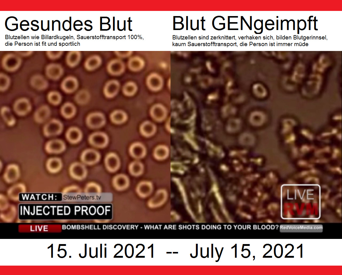 Video mit dem
                              Blutbildvergleich: Blut von Gesunden und
                              von GENgeimpften, 15.7.2021