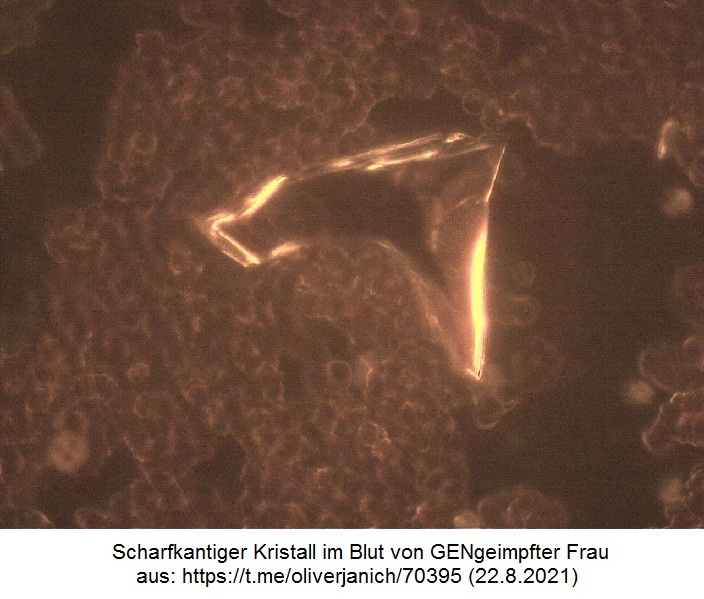Medizinisches
                  22.8.2021: GENimpfung mit scharfkantigen Kristallen