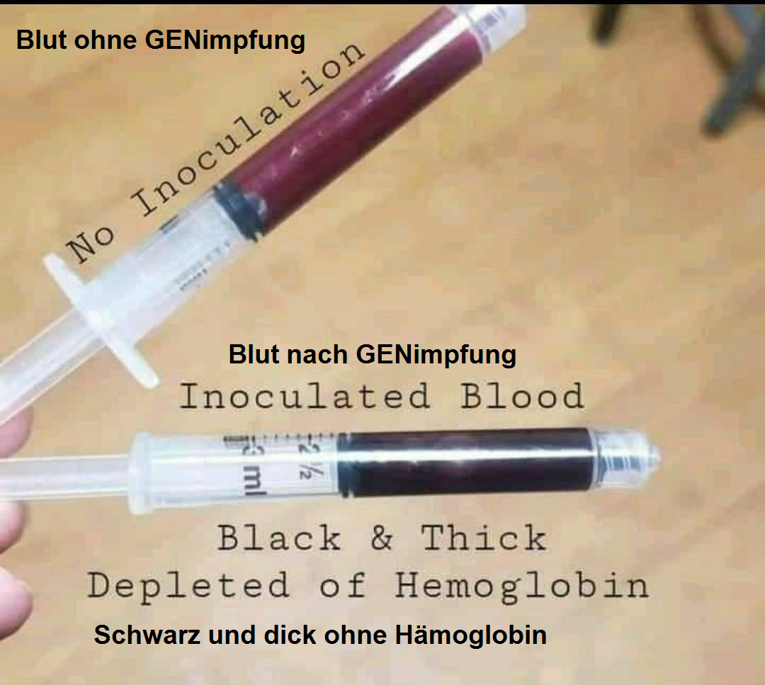 Medizinisches 8.10.2021:
                  Blutvergleich gesundes rotes Blut und GENgeimpftes
                  schwarze Blut ohne Hämoglobin