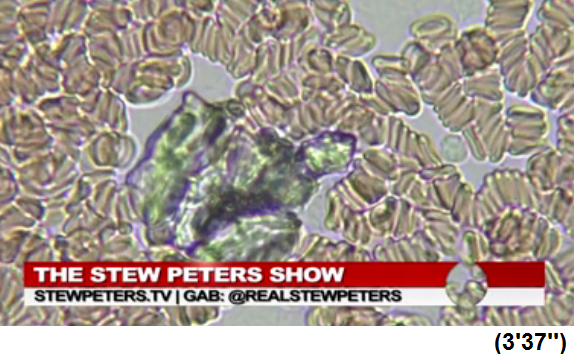 S�dafrika:
                  �rztin Zandre Botha: Schwarzes Objekt wie eine
                  Schildkr�te im Blut