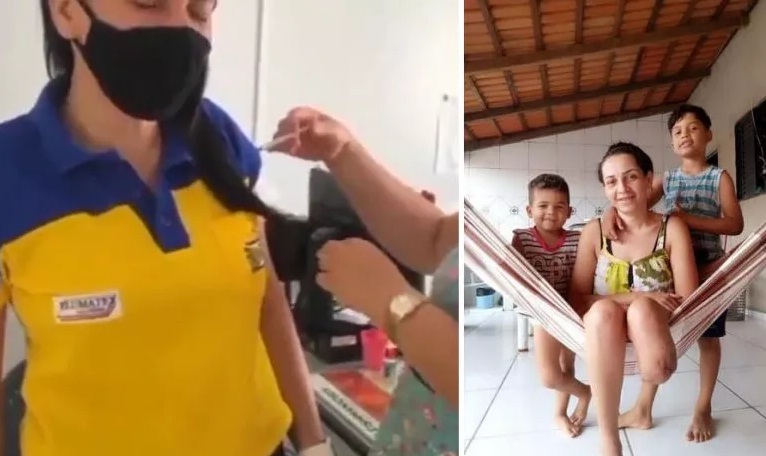 Cicera
                      Santos (Brasilien): Nach GENimpfung von Pfizer 1
                      Unterschenkel amputiert
