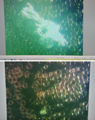 GENimpfschaden Schweiz 24.11.2021:
                  Sehst�rungen, �elkeit, blutiger Stuhlgang, Schwindel,
                  Hirnschaden mit Ged�chtnisst�rung, L�hmungen, Milz
                  gr�sser