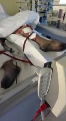 GENimpfmord NRW
                  21.1.2022: Person GENgeimpft stirbt an gigantischen
                  Thrombosen an den Beinen, Foto 3 zeigt schwarze
                  Fusssohlen