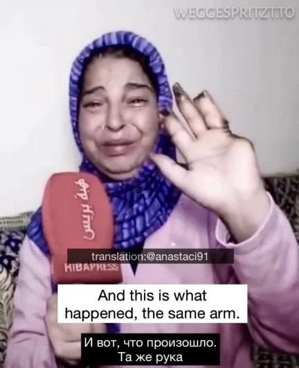 GENimpfschaden Marokko 26.1.2022: Frau
                      GENgeimpft: Am Impfarm faulen die Finger ab