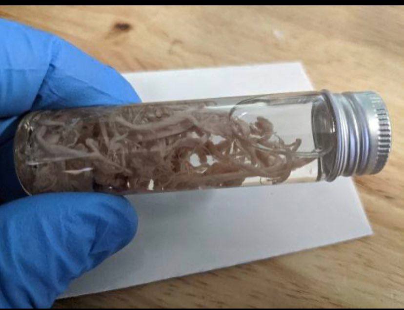 SCHLANGENGIFTimpfmorde weltweit
                                14.6.2022: T�dliche, gummiartige
                                Blutgerinnsel gefunden