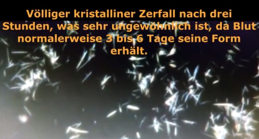 Blutschaden durch "Coronaimpfung"
25.10.2022: Mann (50) 3x Pfizer/BionTech
geimpft+Krebs: Blut zerfällt in 3 Stunden Blutschaden durch "Coronaimpfung"
25.10.2022: Mann (50) 3x Pfizer/BionTech
geimpft+Krebs: Blut zerfällt in 3 Stunden