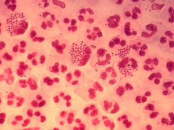 Microbes (ici:
                        Neisseria gonorrhoeae) peuvent imiter les
                        antigènes et ainsi déjouer le système
                        immunitaire quand le régime alimentaire ne
                        correspond pas au groupe sanguin.