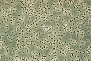 Bakterien wie Bacillus subtilis
                          ("Heubazillus") können durch
                          Farbbestrahlung abgetötet werden
