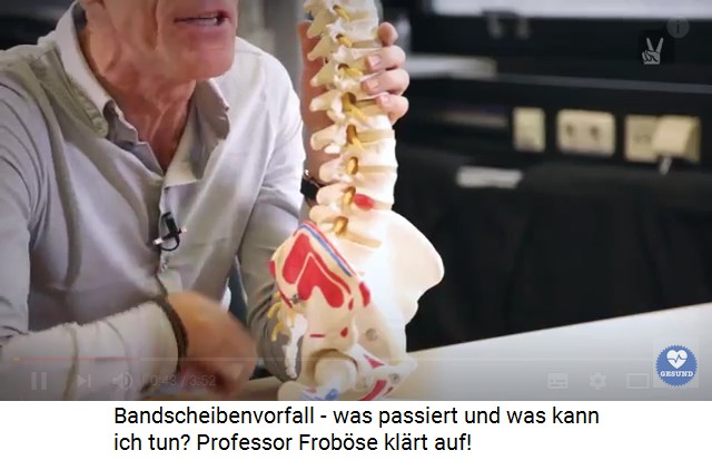 Dr. Ingo Frob�se zeigt ein
                                    Modell einer Wirbels�ule mit einem
                                    Bandscheibenvorfall (der rote
                                    Knubbel an einem der unteren,
                                    grossen Wirbel)