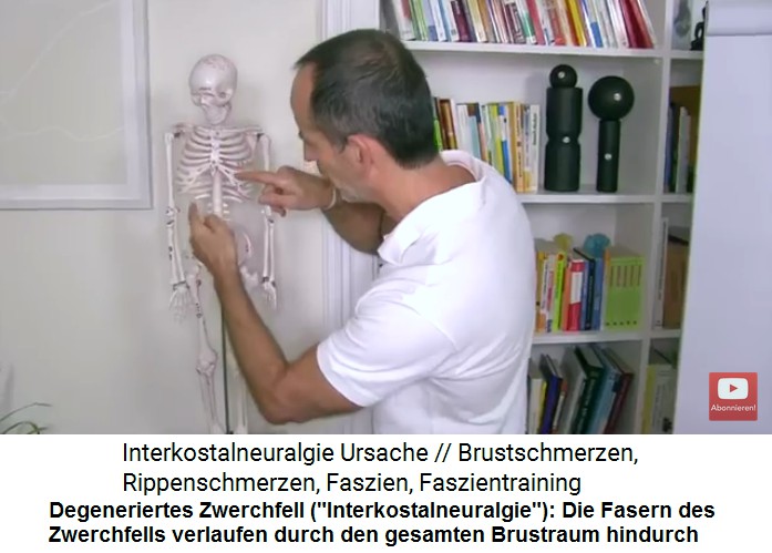 Intercostalneuralgie Video
                    1: Die Zwerchfellfasern verlaufen durch den gesamten
                    Brustraum
