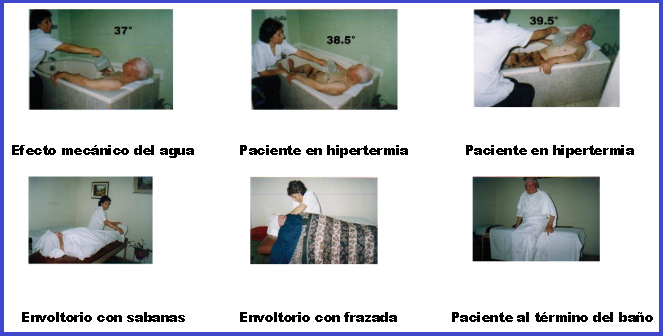 Ba�o de hipertermia con envoltorio
            al fin