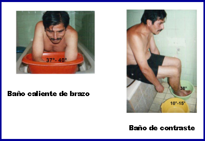 Luyando Joo: ba�o caliente de
            brazos y de pies