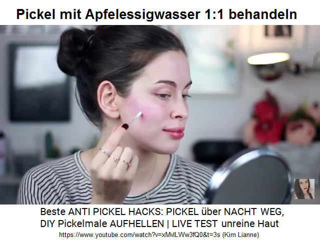 Pickel mit
                              Apfelessigwasser im Verh�ltnis 1:1
                              behandeln