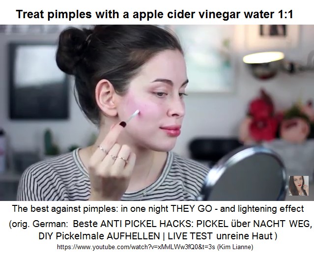 Treat pimples with apple cider
                vinegar water with a ratio of 1:1