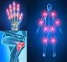 Gelenkschmerzen durch Artritis heilen mit
                      Borax