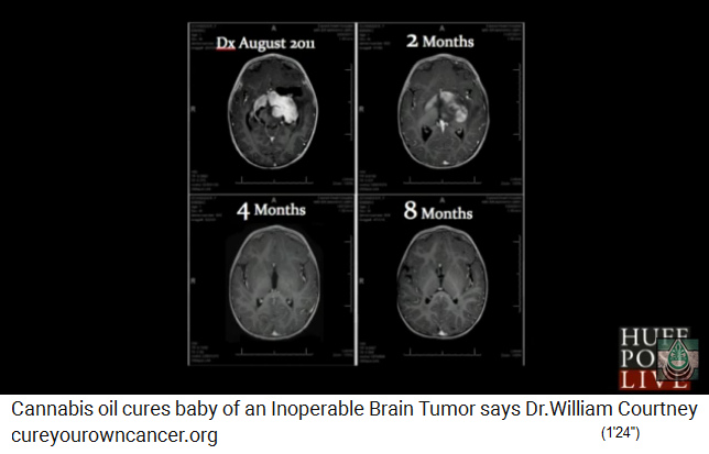 Dr. William
                      Courtney: Ein unheilbarer Hirntumor bei einem 8
                      Monate alten Baby wurde mit 3,8%igen Cannabis�l /
                      Hanf in 8 Monaten weggeheilt. Das Cannabis�l wurde
                      2x t�glich auf den Schnuller aufgetragen - mehr
                      musste man nicht tun. Das Hirn war nach 8 Monaten
                      komplett wiederhergestellt - Webseite:
                      www.cureyourowncancer.org