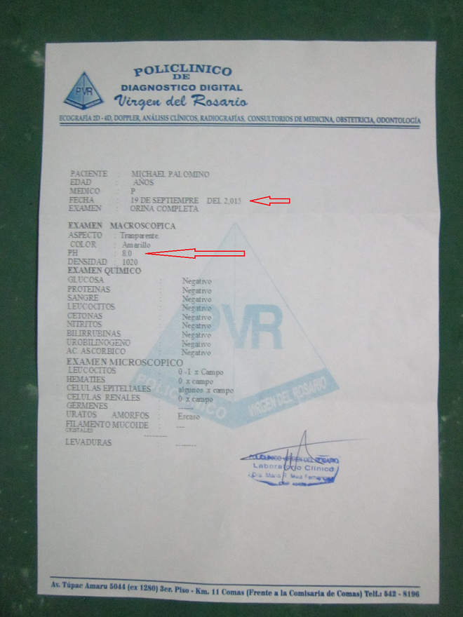 Test de pH du 19
septembre 2015 avec un valeur pH8 dans l'urine Test de pH du 19 septembre 2015 avec un
valeur pH8 dans l'urine