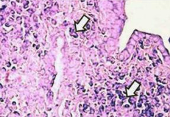 Microfotograf�a de
                          pulm�n de rata intoxicada por antracenonas de
                          una planta silvestre.