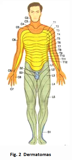 Puntos
                          generales (dermatomas)