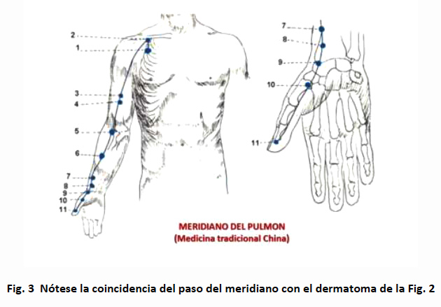 Meridiano del pulm�n
