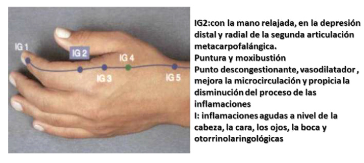 Punto de
                          dolor IG2