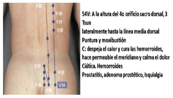 Puntos Lumbagos con punto V54