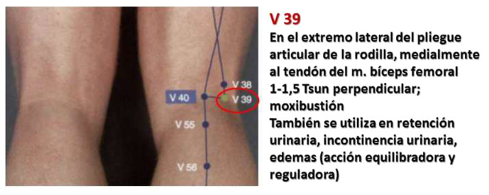 Esguince de rodilla con el punto V39