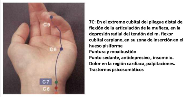 Insomnio con el punto C7