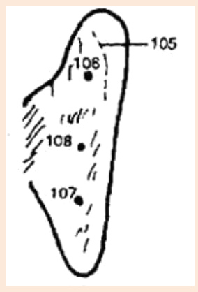 Cartograma auricular,
                            zoom