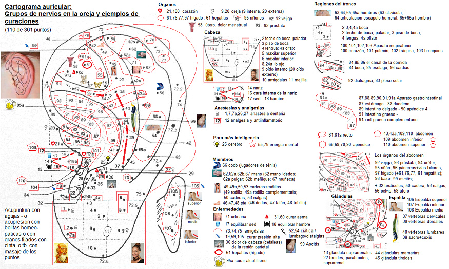 Auriculoterapia: cartograma auricular
                            con grupos de nervios en la oreja y ejemplos
                            de curaciones (110 de 361 puntos)
