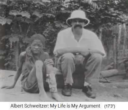 Albert Schweitzer mit
                    einem Patient mit einem verbundenen Schienbein