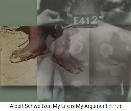 Lambarene, Patienten mit Lepra oder
                    Ausschlag