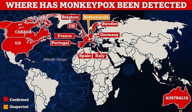 22.5.2022: Krimineller
                    Rothschild streut Meldungen mit Affenpocken - nur im
                    "Westen"