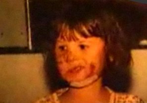 Heridas grandes en la cara por un
                                  perro guardi�n Rottweiler [34]