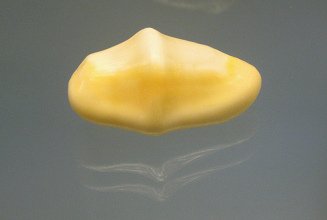 Cyphoma gibbosum, primer plano