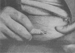 Sireta de
              morfina para exprimir