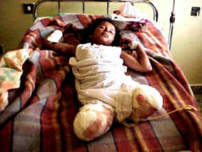 V�ctima de minas: chica sin piernas [1] - y a los
              productores de minas y de guerras no les interesa nada...