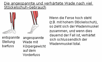 Der
                          angespannte Wadenmuskel verhärtet total, wenn
                          die dummen Frauen viel mit hohen
                          Stöckelschuhen (High-Heels) herumlaufen