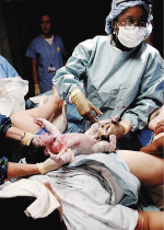 Lancet berichtete im Jahre 2006, dass die
                          Nabelschnur erst 2 Minuten nach der Geburt
                          durchschnitten werden soll. So erh�ht sich der
                          Eisengehalt des Blutes des neugeborenen Kindes
                          und eine Blutarmut wird in den ersten 6
                          Monaten verhindert