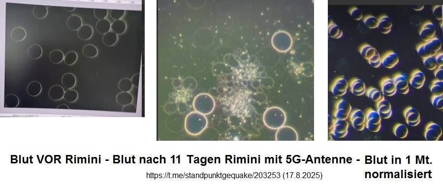 Funkende 5G-Antenne 11 Tage in Rimini am
17.8.2025: zerstört das Blut von TouristInnen -
Naturärztin dokumentiert es mit Vorher-Nachher-1 Monat
danach Funkende 5G-Antenne 11 Tage in Rimini am
17.8.2025: zerstört das Blut von TouristInnen -
Naturärztin dokumentiert es mit Vorher-Nachher-1 Monat
danach