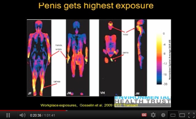 Am meisten
              gef�hrdet sind die Gelenke, die Nase und die m�nnlichen
              Geschlechtsorgane.